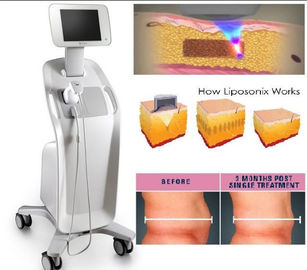 Emagrecimento focalizado alta intensidade Mchine de Liposonix do ultrassom, máquina da face lift do ultrassom