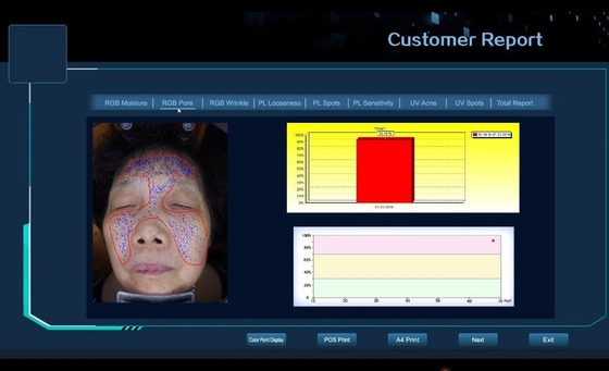 poro facial da pele da máquina de testes da pele 3D, enrugamento, pontos, dispositivo da análise da acne
