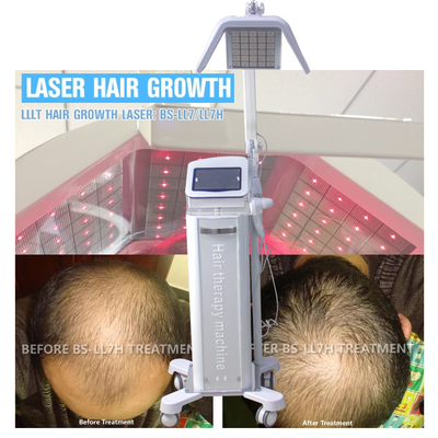 Máquina ajustável do crescimento do laser do cabelo da energia com os diodos láser reais do comprimento de onda 650nm/670nm