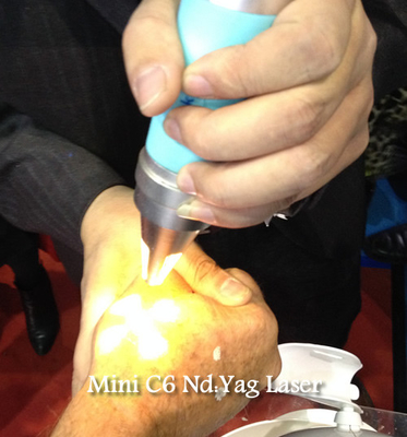 Nd 1064 da máquina da remoção da tatuagem do laser de Yag do de alta energia Yag 532 nanômetro com o CE aprovado