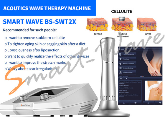 Remoção das celulites da máquina da terapia da onda acústica do salão de beleza BS-SWT2X garantia de 1 ano