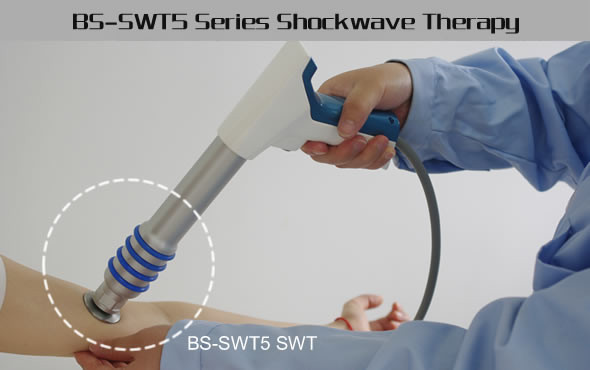 FDA aprovou o equipamento extracorporal da terapia da onda de choque do CE do alívio das dores da inquietação do smartwave da fábrica da porcelana