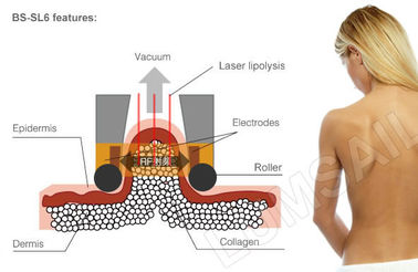 Sistema de contorno mais magro gordo do corpo de máquina do emagrecimento do gelo de Cryolipolysis para a resolução gorda