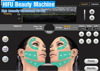 Ultrassom focalizado da máquina da beleza de Hifu alta intensidade portátil para a imagem latente médica da precisão