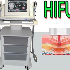 Ultrassom focalizado da máquina da beleza de Hifu alta intensidade portátil para a imagem latente médica da precisão