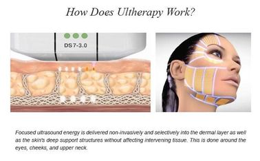 Máquina focalizada alta intensidade da beleza do ultrassom HIFU para o tratamento da cara no salão de beleza