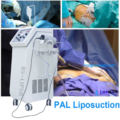 Sistema de lipoaspiração assistido pelo sistema de contorno do corpo PAL Cirurgião estético