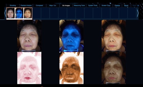 O espectro 6 considera um equipamento facial mais claro da análise da pele do problema de pele