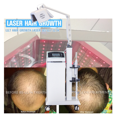 A terapia do laser da terapia LLLT do cabelo cresce o cabelo com a máquina real da rebrota do cabelo do laser dos diodos