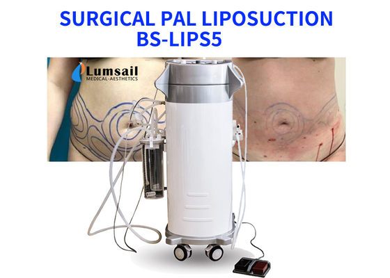 O poder de BS-LIPS5 300W ajudou ao equipamento da lipoaspiração para o peito e o Chin do pescoço